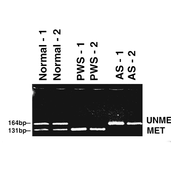prader-willi syndrome mutation detection methylation specific pcr